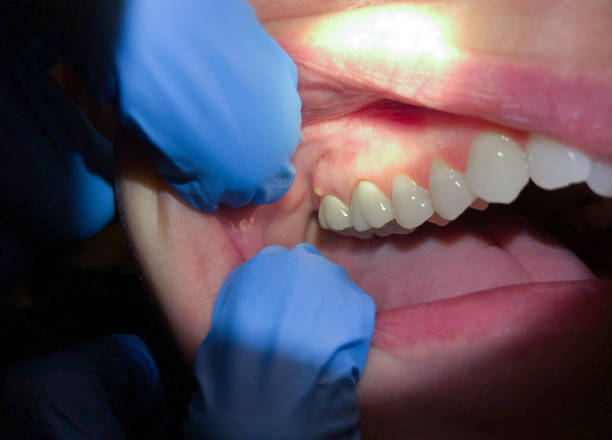 Best Urgent Care for Lost Fillings or Crowns in Anahuac, TX