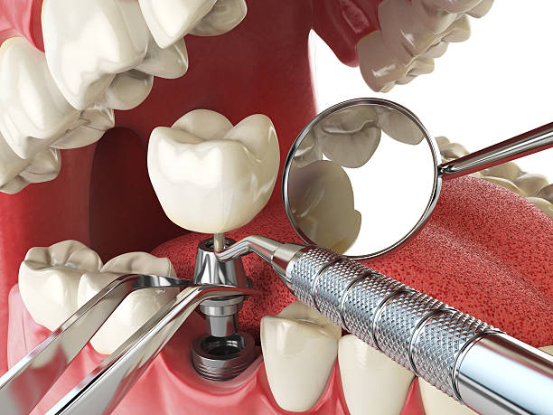 Best Emergency Gum Treatment in Anahuac, TX